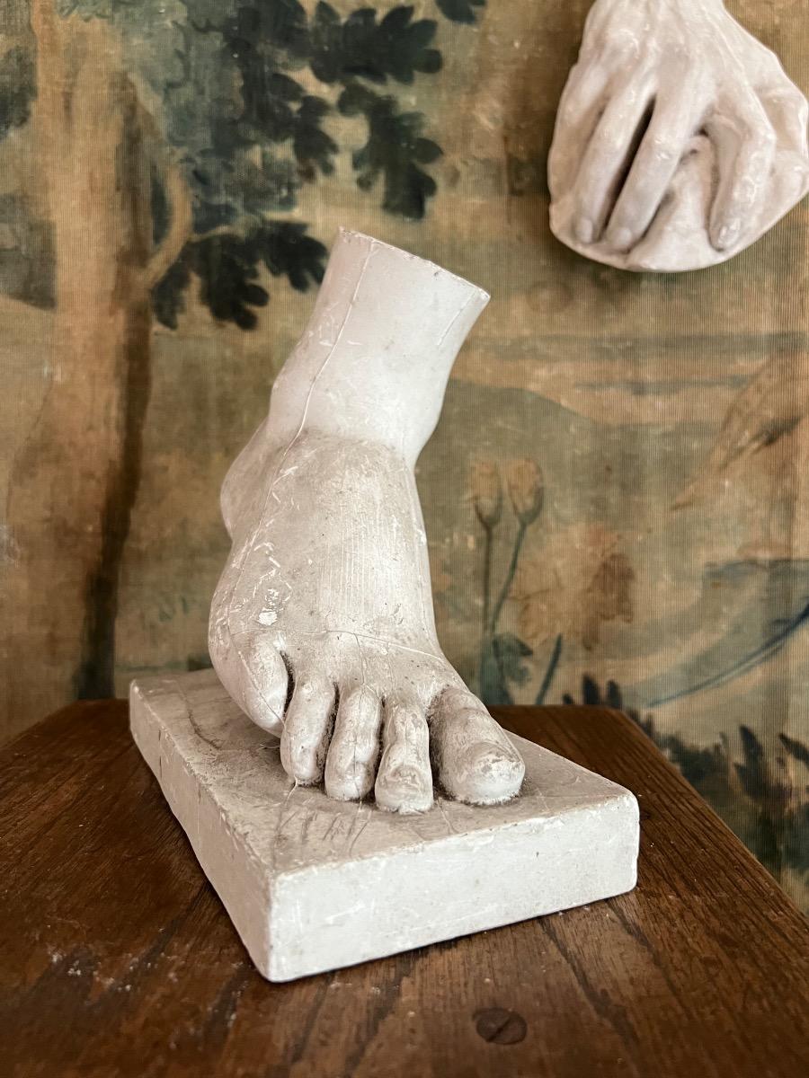 Main et pied plâtre 1930